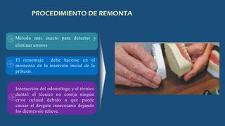 Método más exacto para detectar y
eliminar errores
El remontaje debe hacerse en el
momento de la inserción inicial de la
prótesis.
Interacción del odontólogo y el técnico
dental: el técnico no corrija ningún
error oclusal debido a que puede
causar el desgate innecesario dejando
los dientessin relieve.
 