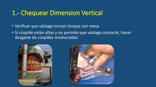 1.- Chequear Dimension Vertical
• Verificar que vástago incisal choque con mesa
• Si cúspide están altas y no permite que vástago contacte, hacer
desgaste de cúspides involucradas
 