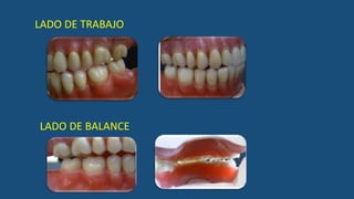 LADO DE TRABAJO
LADO DE BALANCE
 