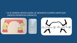 • SI SE GENERA DESOCLUSION, SE DESGASTA CUSPIDE HASTA QUE
DIENTES ENTREN EN CONTACTO
 