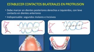 ESTABLECER CONTACTOS BILATERALES EN PROTRUSION
• Debe marcar en dientes posteriores derechos e izquierdos, con leve
contacto en dientes anteriores
• Indispensable: segundos molares e Incisivos
 