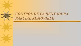 CONTROL DE LA DENTADURA
PARCIAL REMOVIBLE
 