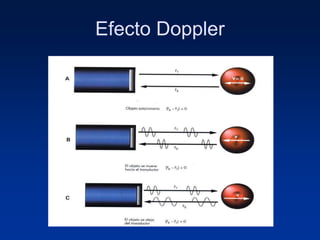 Efecto Doppler
 