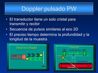 Doppler pulsado PW
• El transductor tiene un solo cristal para
transmitir y recibir
• Secuencia de pulsos similares al eco 2D
• El preciso tiempo determina la profundidad y la
longitud de la muestra
 