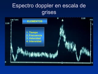 Espectro doppler en escala de
grises
ELEMENTOS
1. Tiempo
2. Frecuencia
3. Velocidad
4. Intensidad
 