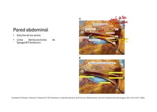 Comprehensive Overview of Abdominal Wall Anatomy and Hernias: Diagnosis ...