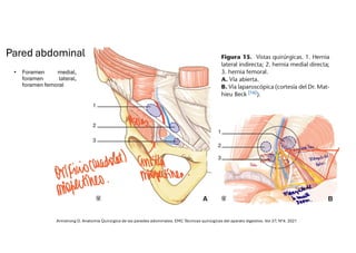 Comprehensive Overview of Abdominal Wall Anatomy and Hernias: Diagnosis ...