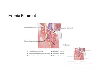 Comprehensive Overview of Abdominal Wall Anatomy and Hernias: Diagnosis ...
