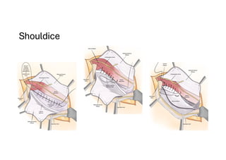 Comprehensive Overview of Abdominal Wall Anatomy and Hernias: Diagnosis ...