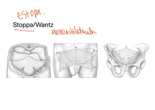 Comprehensive Overview of Abdominal Wall Anatomy and Hernias: Diagnosis ...