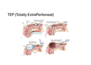 Comprehensive Overview of Abdominal Wall Anatomy and Hernias: Diagnosis ...