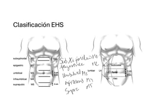 Comprehensive Overview of Abdominal Wall Anatomy and Hernias: Diagnosis ...