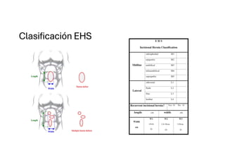 Comprehensive Overview of Abdominal Wall Anatomy and Hernias: Diagnosis ...