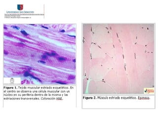 Clase 18. Tejido Muscular