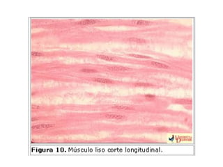 Clase 18. Tejido Muscular