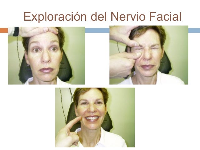 Clase 18 evaluacion pares craneales nervio facial