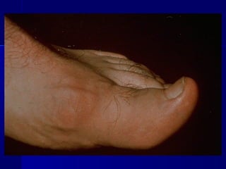 Clase #19   trastornos metabólicos