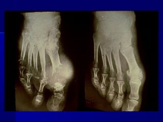 Clase #19   trastornos metabólicos