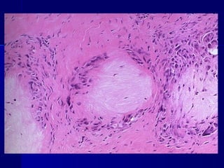Clase #19   trastornos metabólicos