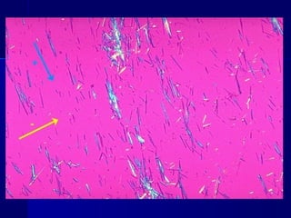 Clase #19   trastornos metabólicos