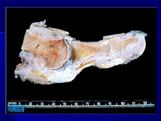 Clase #19   trastornos metabólicos