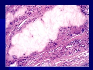 Clase #19   trastornos metabólicos