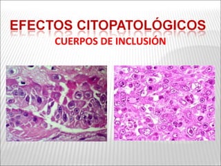 CUERPOS DE INCLUSIÓN
 