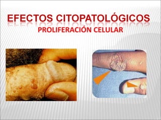 PROLIFERACIÓN CELULAR
 