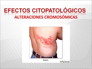 ALTERACIONES CROMOSÓMICAS
 