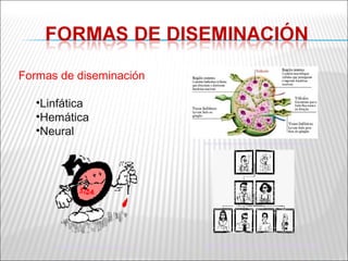 Formas de diseminación

   •Linfática
   •Hemática
   •Neural
                                                 http://www.nenossolar.com.br/escolademediuns/ganglios.jpg




      http://www.grupoelron.org/im2/sida13.gif   http://webpages.ull.es/users/feteugt/ecos/eco004/04_dib.gif
 
