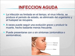   La infección es limitada en el tiempo, el virus infecta, se
    produce el periodo de estado, es eliminado del organismo y
    el huésped se recupera.
   A veces puede seguir una evolución grave y producir la
    muerte, hecho bastante menos frecuente.
   Puede presentarse con o sin síntomas (sintomática o
    asintomática).
 