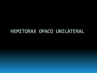 HEMITORAX OPACO UNILATERAL
 