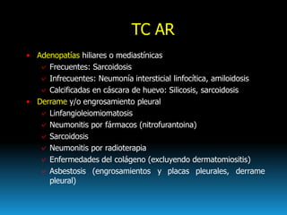 TC AR
• Adenopatías hiliares o mediastínicas
✓ Frecuentes: Sarcoidosis
✓ Infrecuentes: Neumonía intersticial linfocítica, ...