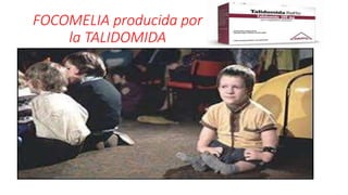 Focomelia Rx BIOFARMACIA BIOFARMACIA BIOFARMACIA BIOFARMACIA | PPTX