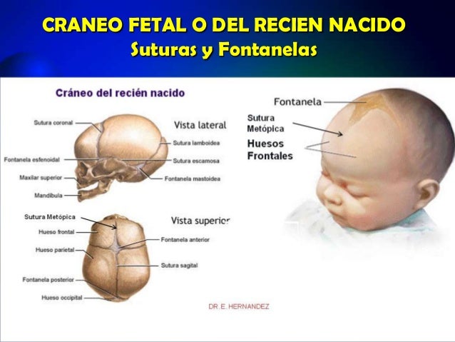 FONTANELAS CRANEO PDF FONTANELAS CRANEO PDF