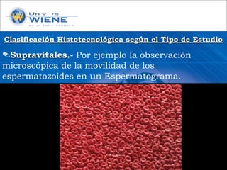 Clasificación Histotecnológica según el Tipo de EstudioClasificación Histotecnológica según el Tipo de Estudio
✎SupravitalesSupravitales.- Por ejemplo la observación
microscópica de la movilidad de los
espermatozoides en un Espermatograma.
 