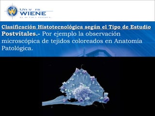 Clasificación Histotecnológica según el Tipo de EstudioClasificación Histotecnológica según el Tipo de Estudio
PostvitalesPostvitales.- Por ejemplo la observación
microscópica de tejidos coloreados en Anatomía
Patológica.
 