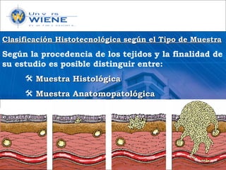 Clasificación Histotecnológica según el Tipo de MuestraClasificación Histotecnológica según el Tipo de Muestra
Según la procedencia de los tejidos y la finalidad de
su estudio es posible distinguir entre:
 Muestra HistológicaMuestra Histológica
 Muestra AnatomopatológicaMuestra Anatomopatológica
 