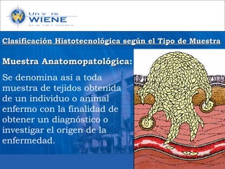 Muestra AnatomopatológicaMuestra Anatomopatológica:
Se denomina así a toda
muestra de tejidos obtenida
de un individuo o animal
enfermo con la finalidad de
obtener un diagnóstico o
investigar el origen de la
enfermedad.
Clasificación Histotecnológica según el Tipo de MuestraClasificación Histotecnológica según el Tipo de Muestra
 
