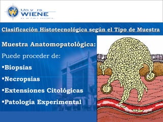 Muestra AnatomopatológicaMuestra Anatomopatológica:
Puede proceder de:
•Biopsias
•Necropsias
•Extensiones Citológicas
•Patología Experimental
Clasificación Histotecnológica según el Tipo de MuestraClasificación Histotecnológica según el Tipo de Muestra
 