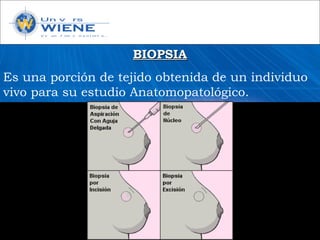 BIOPSIABIOPSIA
Es una porción de tejido obtenida de un individuo
vivo para su estudio Anatomopatológico.
 