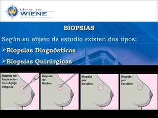 BIOPSIASBIOPSIAS
Según su objeto de estudio existen dos tipos:
Biopsias DiagnósticasBiopsias Diagnósticas
Biopsias QuirúrgicasBiopsias Quirúrgicas
 