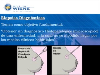 Biopsias DiagnósticasBiopsias Diagnósticas
Tienen como objetivo fundamental:
“Obtener un diagnóstico Histopatológico (microscópico)
de una enfermedad, a la cual no se a podido llegar por
los medios clínicos habituales”
 