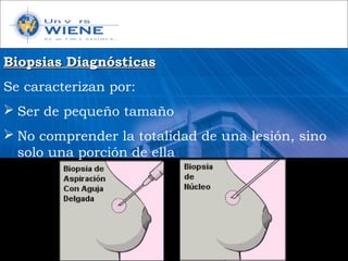 Biopsias DiagnósticasBiopsias Diagnósticas
Se caracterizan por:
 Ser de pequeño tamaño
 No comprender la totalidad de una lesión, sino
solo una porción de ella
 
