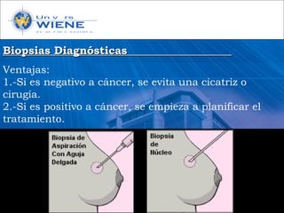 Biopsias DiagnósticasBiopsias Diagnósticas
Ventajas:
1.-Si es negativo a cáncer, se evita una cicatriz o
cirugía.
2.-Si es positivo a cáncer, se empieza a planificar el
tratamiento.
 