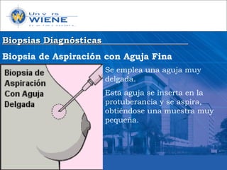 Biopsias DiagnósticasBiopsias Diagnósticas
Biopsia de Aspiración con Aguja Fina
Se emplea una aguja muy
delgada.
Esta aguja se inserta en la
protuberancia y se aspira,
obtiéndose una muestra muy
pequeña.
 