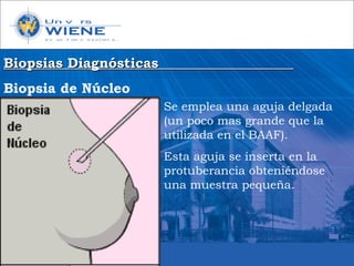 Biopsias DiagnósticasBiopsias Diagnósticas
Biopsia de Núcleo
Se emplea una aguja delgada
(un poco mas grande que la
utilizada en el BAAF).
Esta aguja se inserta en la
protuberancia obteniéndose
una muestra pequeña.
 