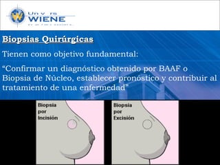 Biopsias QuirúrgicasBiopsias Quirúrgicas
Tienen como objetivo fundamental:
“Confirmar un diagnóstico obtenido por BAAF o
Biopsia de Núcleo, establecer pronóstico y contribuir al
tratamiento de una enfermedad”
 