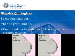 Biopsias QuirúrgicasBiopsias Quirúrgicas
Se caracterizan por:
Ser de gran tamaño.
Comprende la totalidad de la lesión, y a menudo
órganos enteros.
 