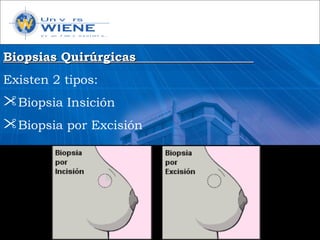 Biopsias QuirúrgicasBiopsias Quirúrgicas
Existen 2 tipos:
Biopsia Insición
Biopsia por Excisión
 